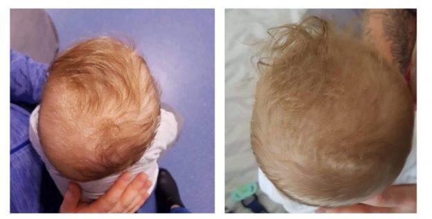 Donevan-Before-and-After-1