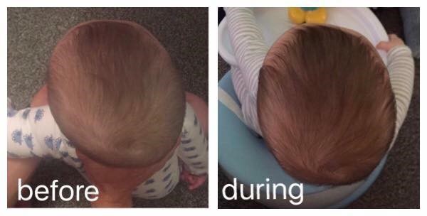 Ollie-Before-and-after-flat-head-treatment