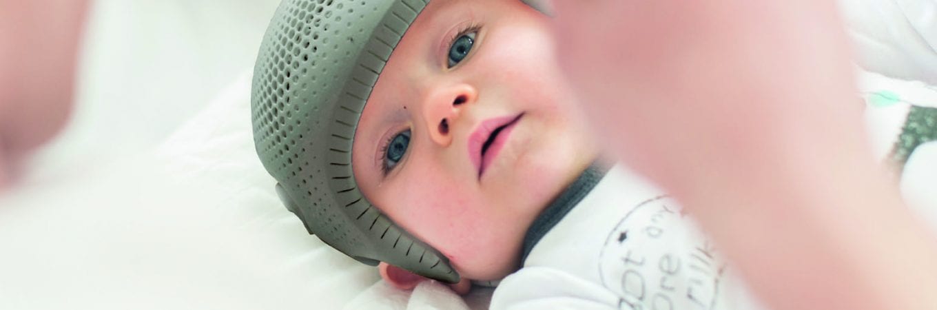 Are Plagiocephaly Pillows for Flat Head Syndrome Safe to Use?