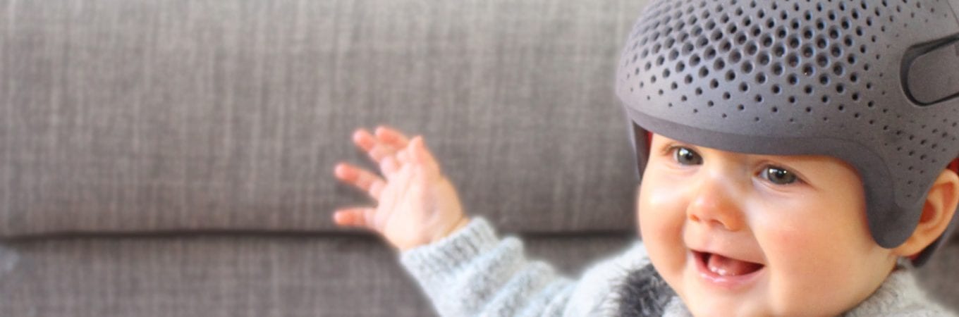 5 Signs a Plagiocephaly Helmet May Not be Needed