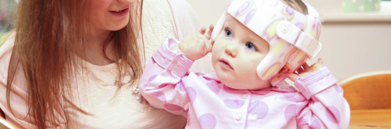 How Long Does it Take to Correct Plagiocephaly?