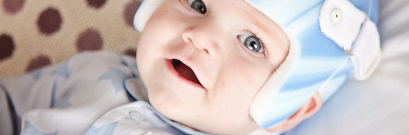 The Back to Sleep Campaign and Plagiocephaly
