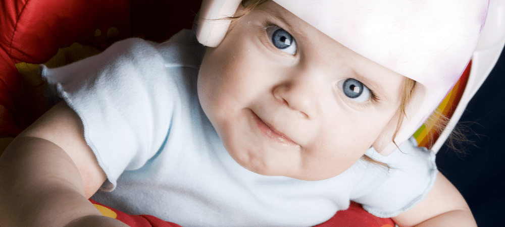 Why Can’t You Get a Plagiocephaly Helmet on the NHS?