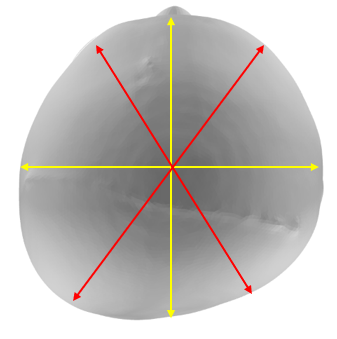 Two-diagonal-measurements-from-the-corner-of-the-eye-to-the-opposite-diagonal-corner