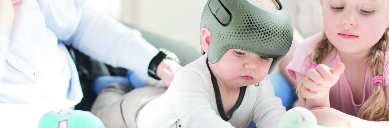 Choosing a Plagiocephaly Clinic