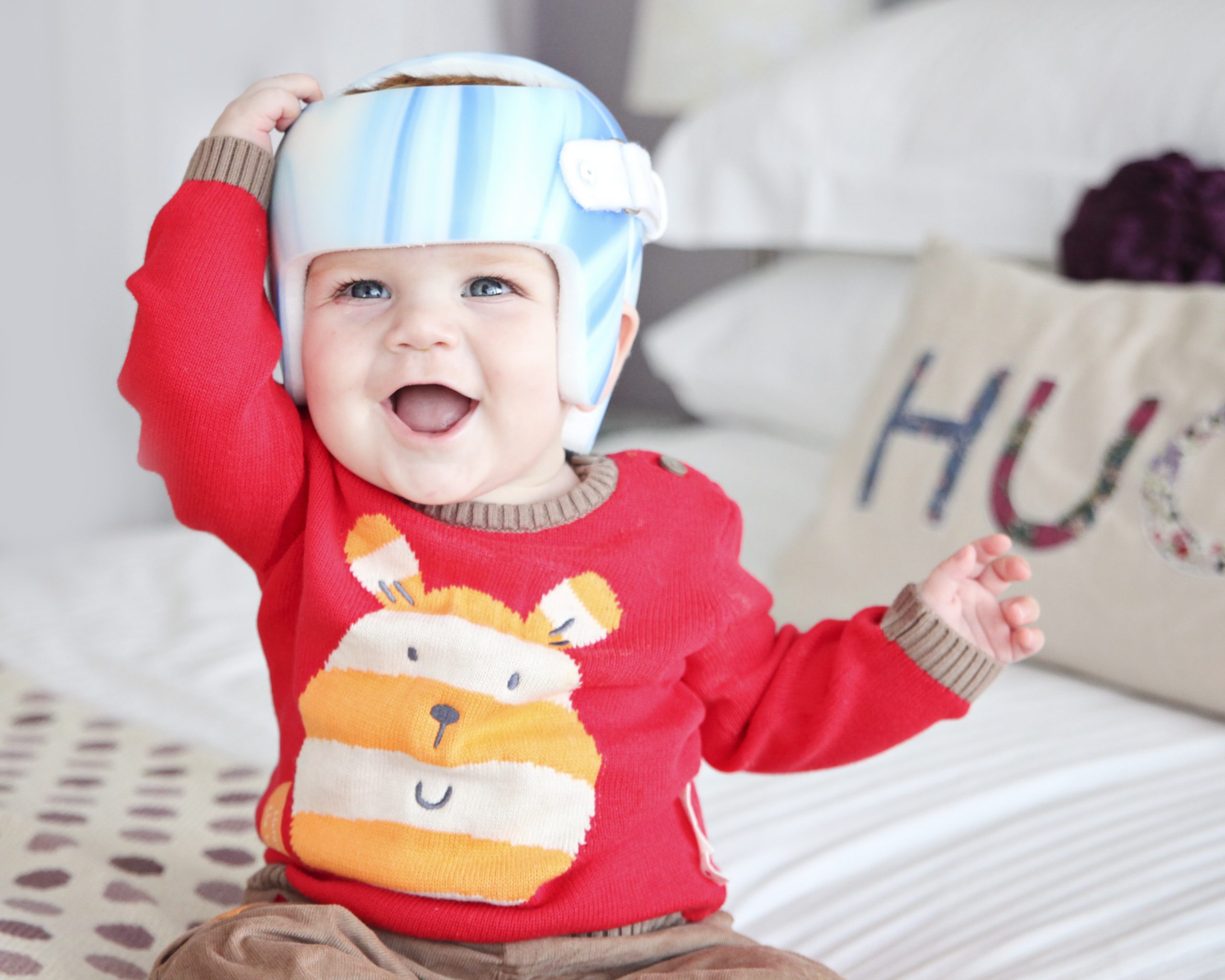 Helmet therapy demonstrates its efficacy in treating babies