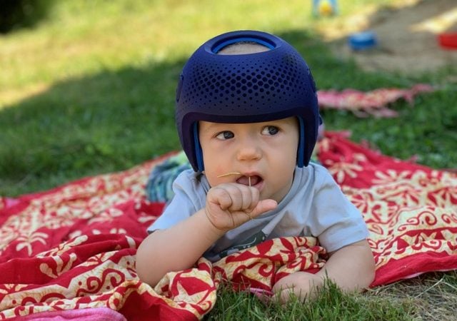 How Illness Affects Wearing a Plagiocephaly Helmet