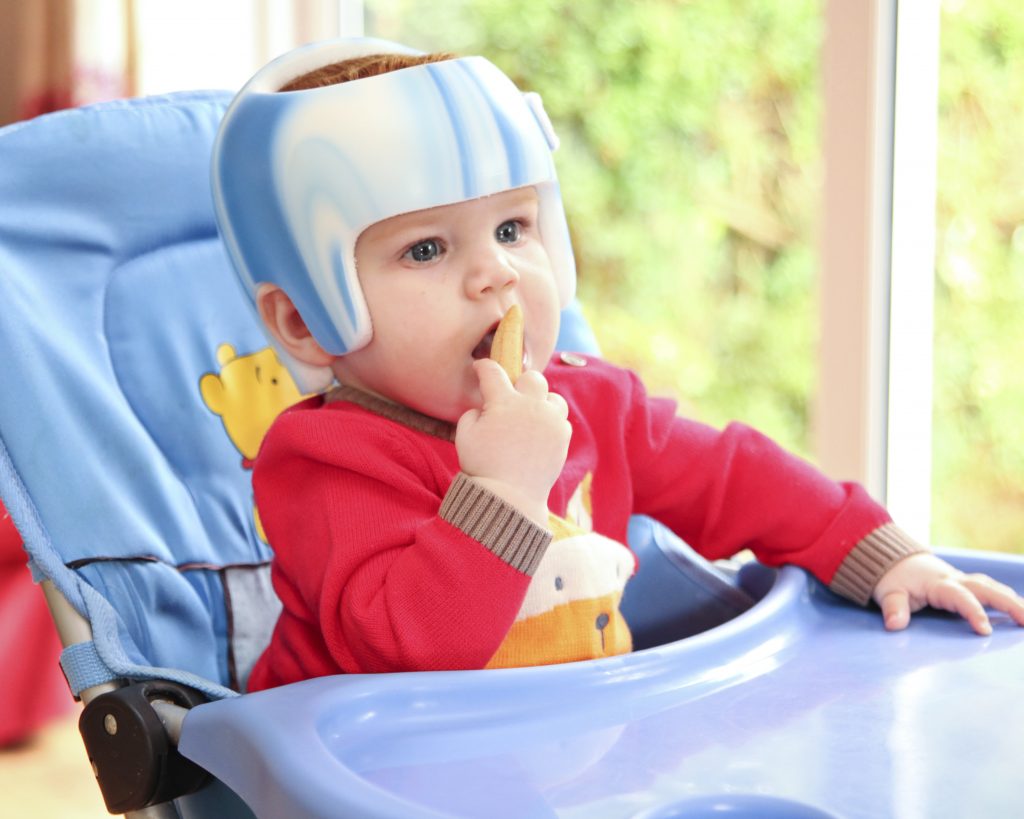 how-effective-are-helmets-for-plagiocephaly