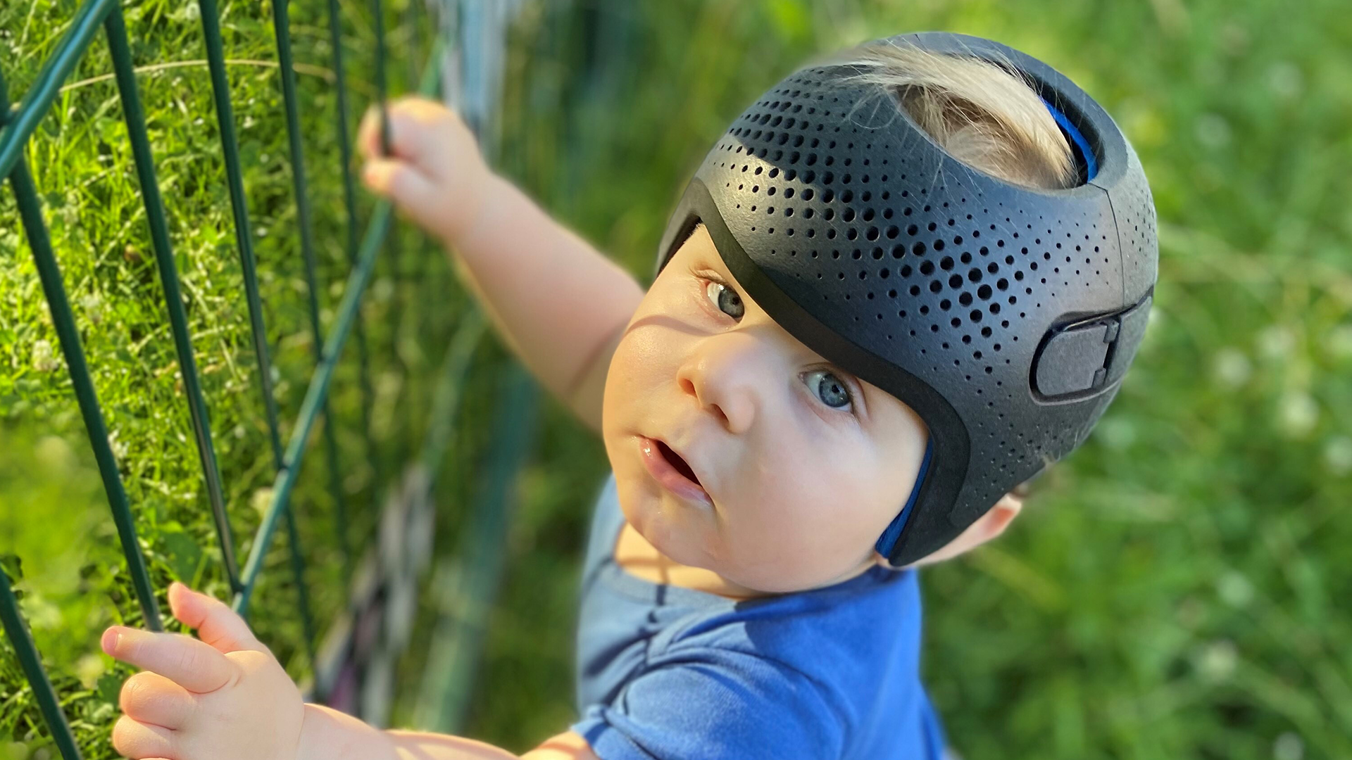 How to keep a Plagiocephaly Helmet clean