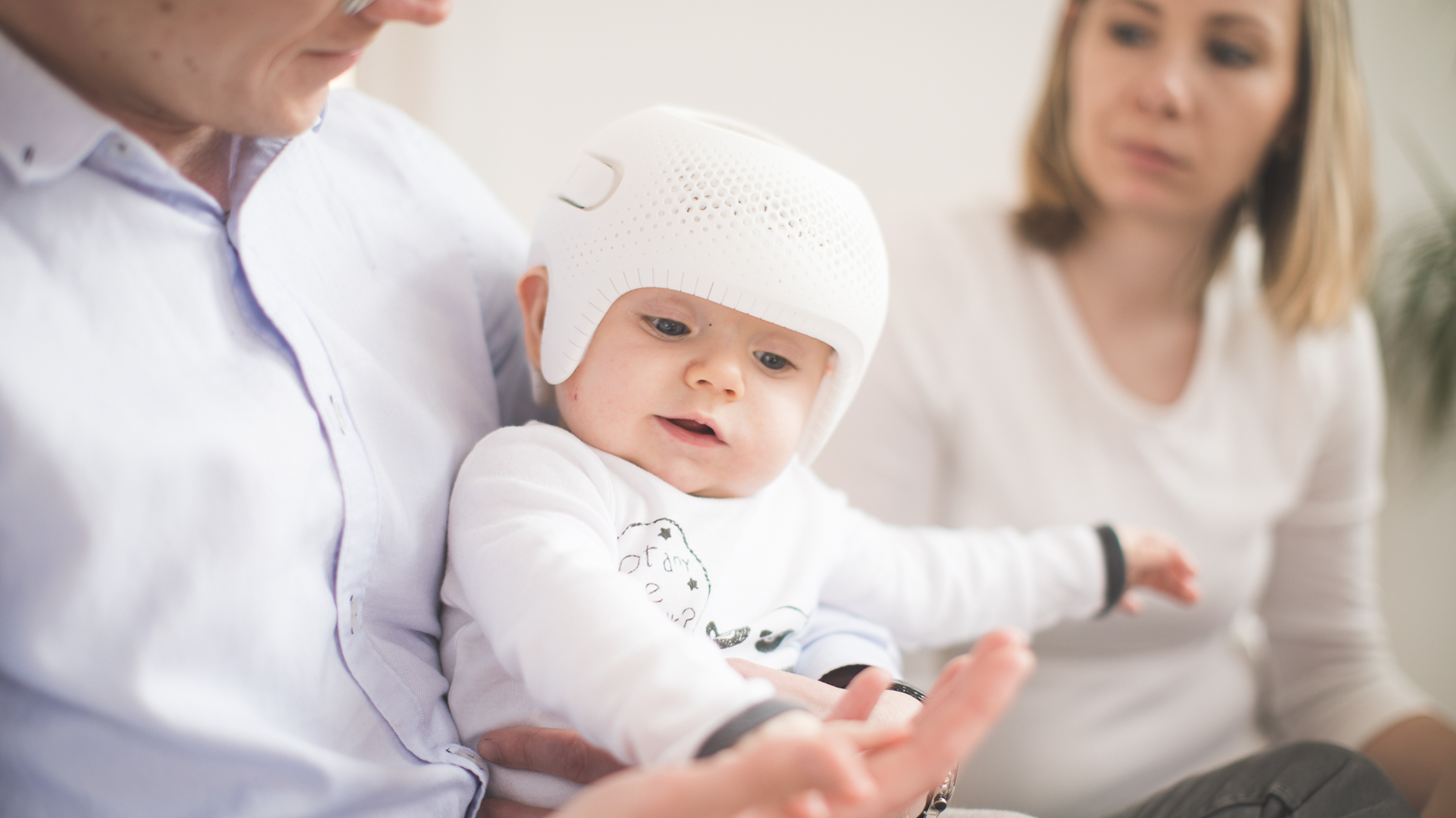 Identify & Measure Plagiocephaly | Parents Severity Scale