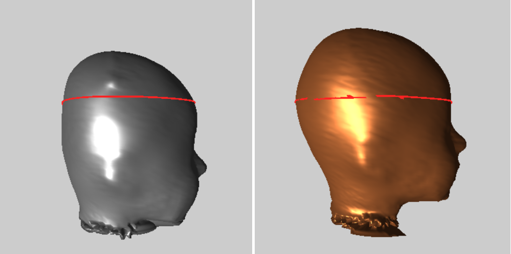 Before and After Side Profile