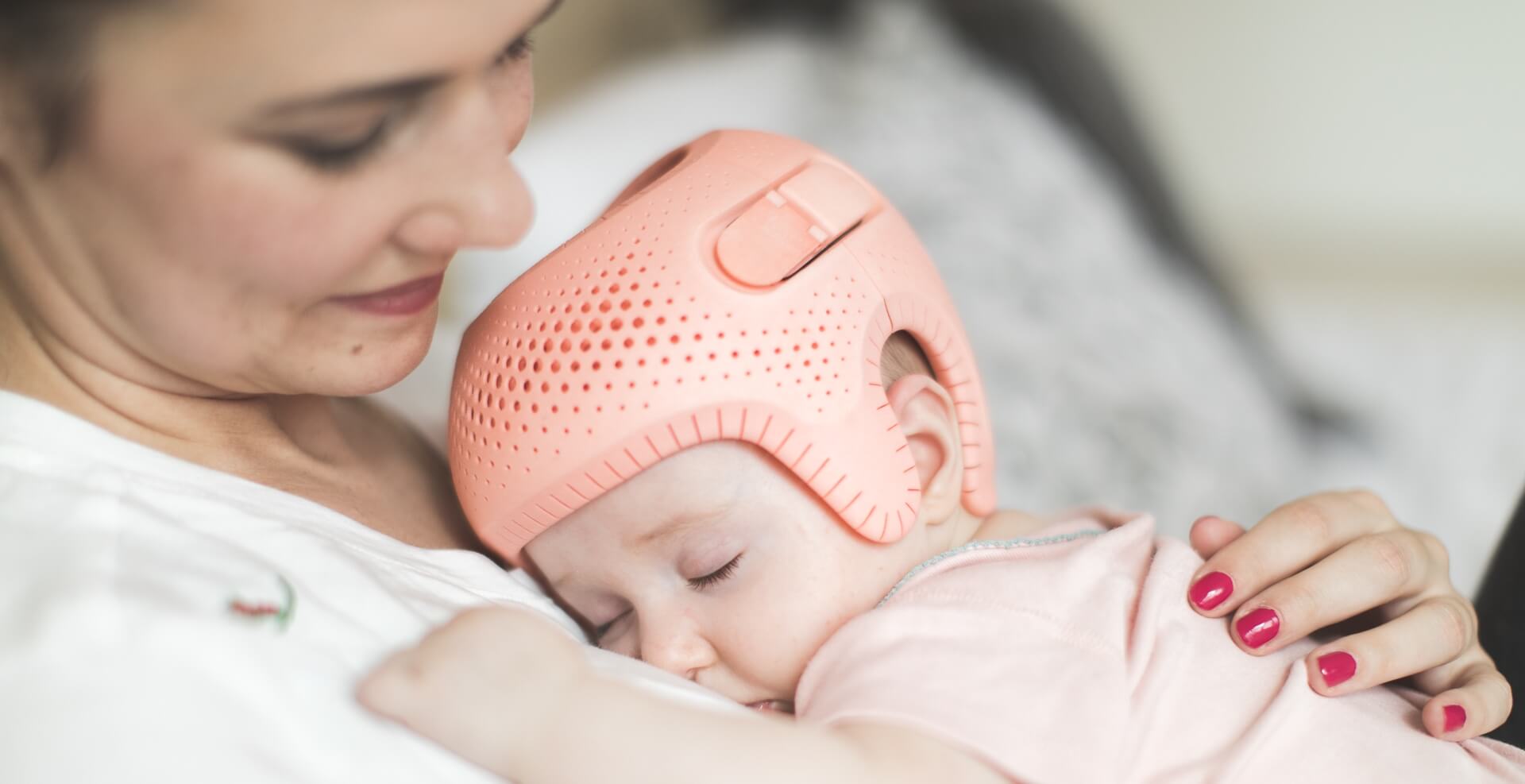 Plagiocephaly: How to Recognise Plagiocephaly in Babies