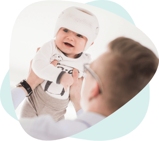 plagiocephaly-1