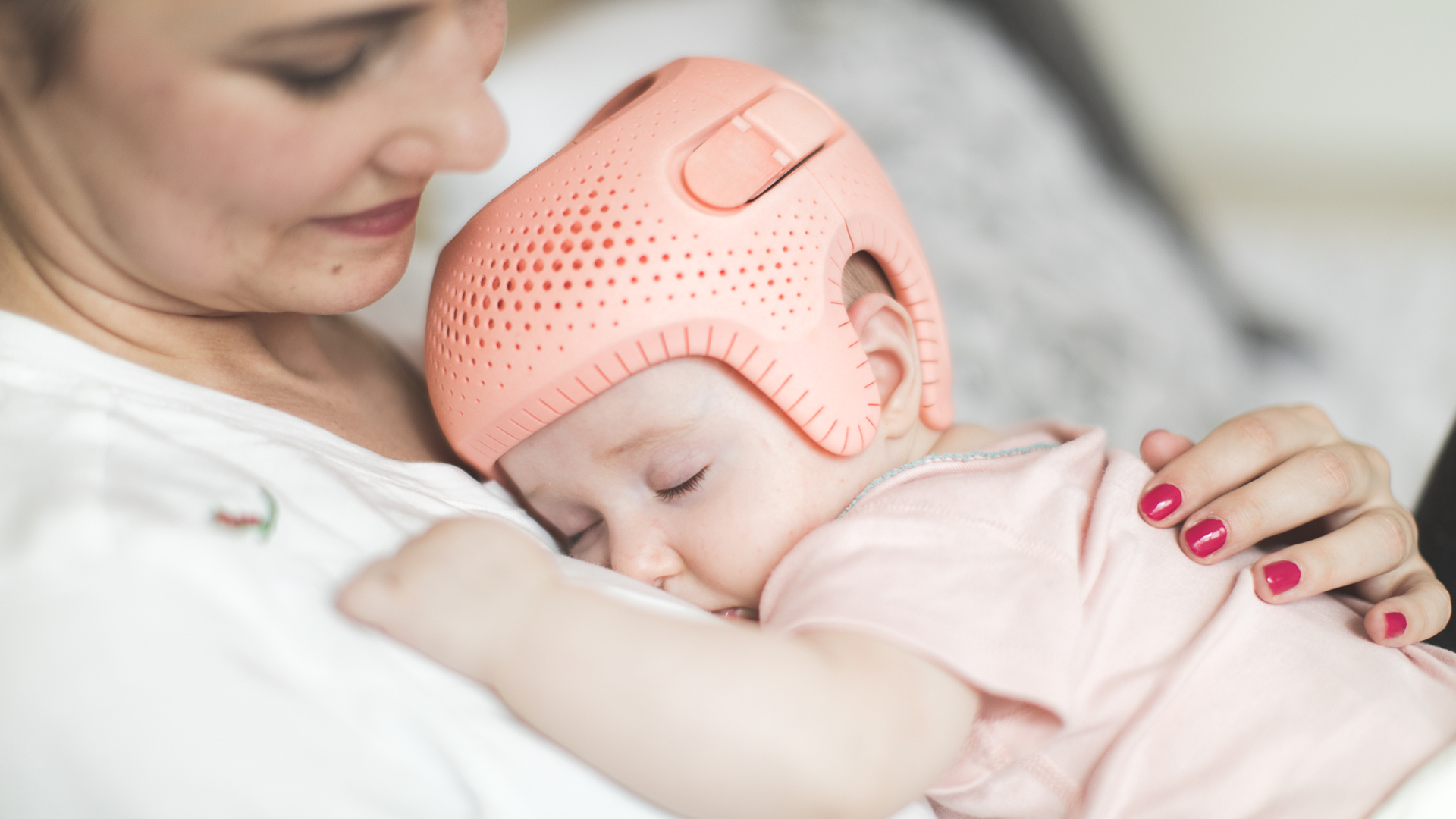 Is Plagiocephaly Just Cosmetic, Why Bother with Treatment?