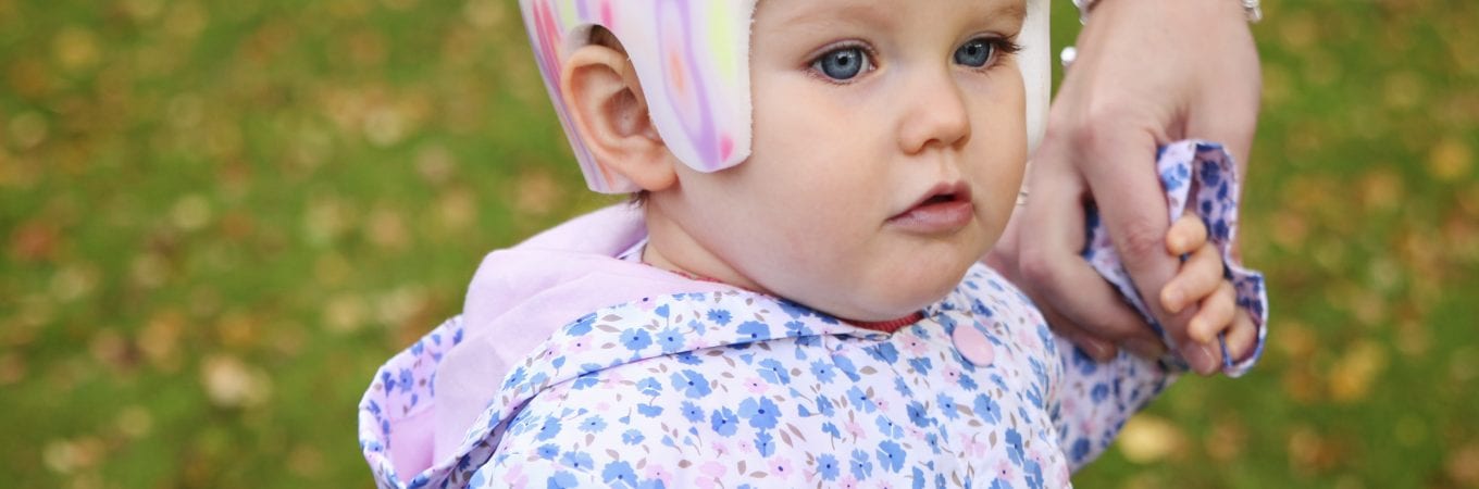 Plagiocephaly in Summer: Keeping Your Baby Cool