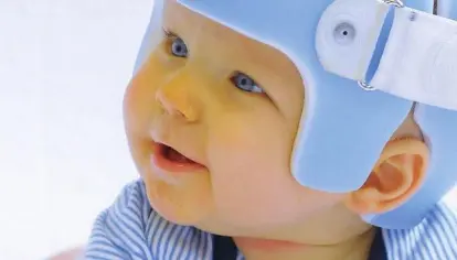 plagiocephaly_awareness