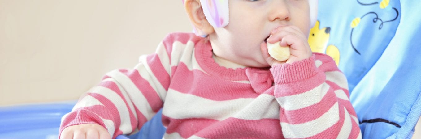 Are There Links Between Plagiocephaly & Developmental Delay?