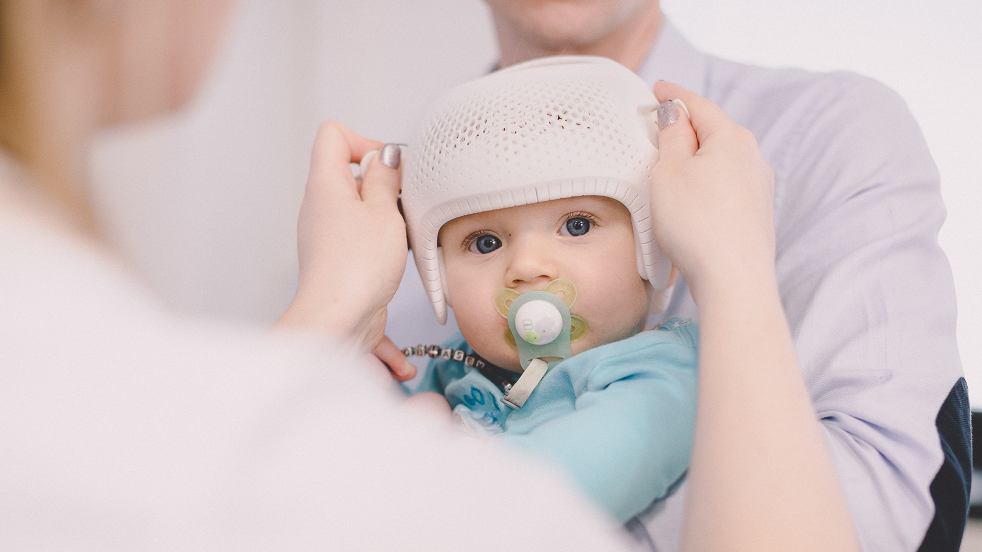 relationship-between-plagiocephaly-torticollis